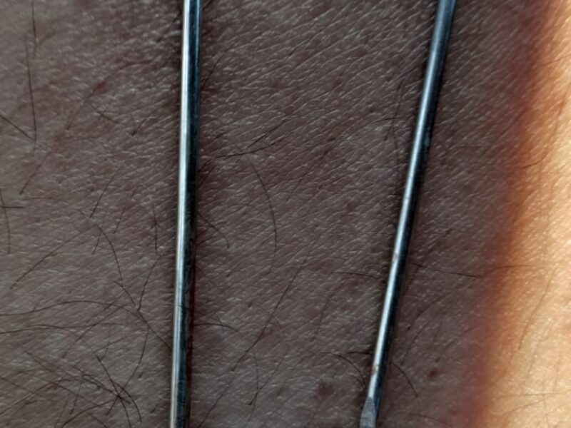 Faja para columna y aguja de kisneer